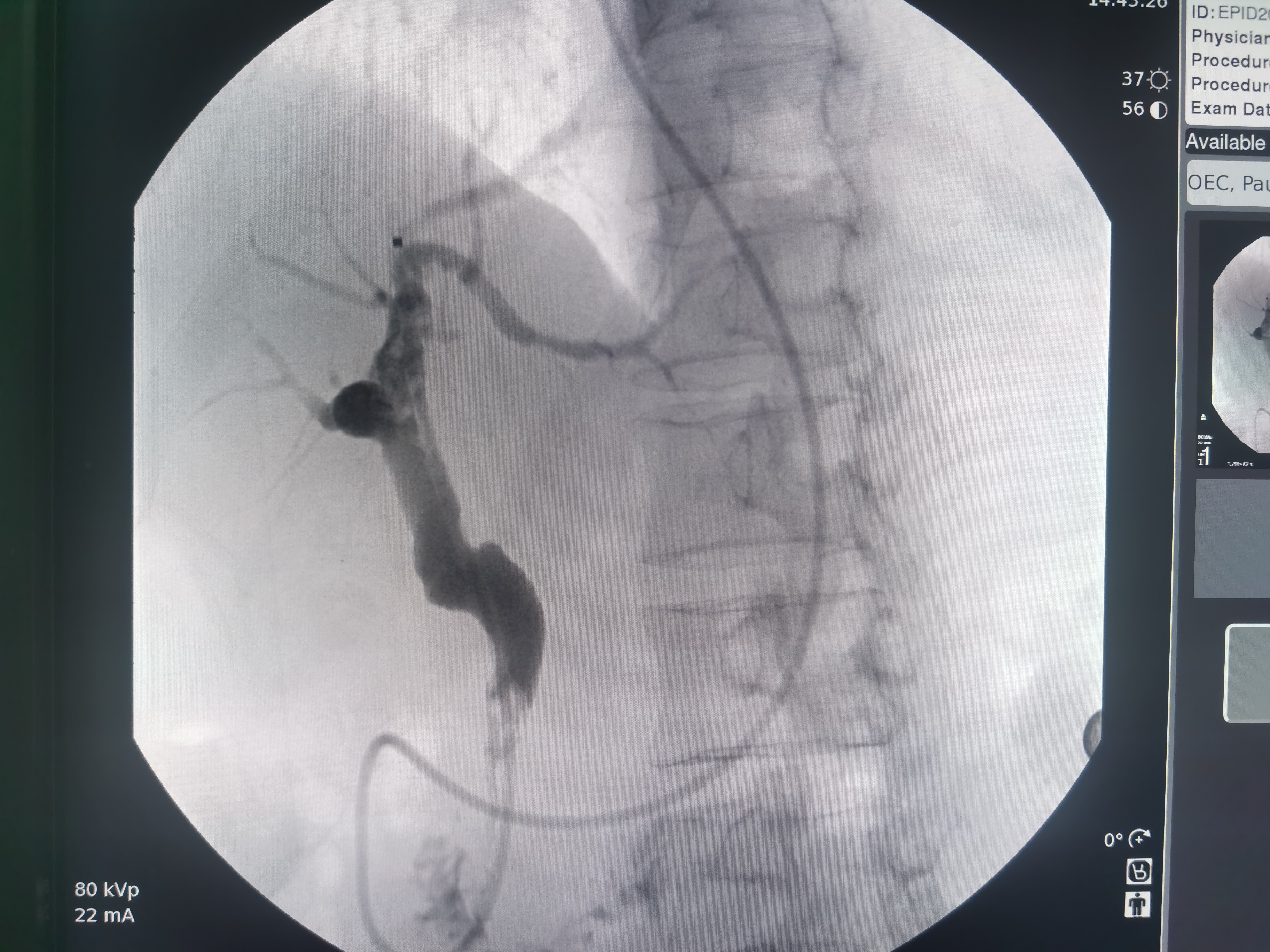 蘭州市排查醫(yī)療器械安全風險隱患